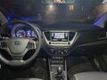 2017 Hyundai Solaris II, серый, 1300000 рублей - вид 9