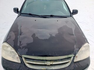2011 Chevrolet Lacetti I, чёрный, 399000 рублей, вид 2