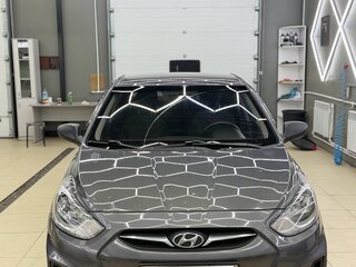 2011 Hyundai Solaris I, серый, 650000 рублей, вид 3