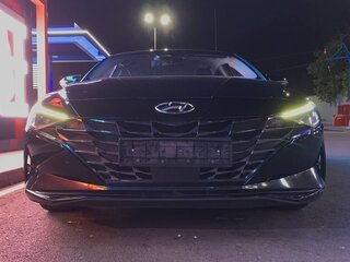 2020 Hyundai Avante VII, чёрный, 1363000 рублей, вид 2