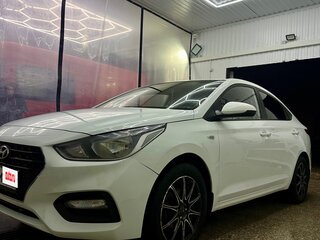 2018 Hyundai Solaris II, белый, 890000 рублей, вид 5