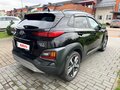 2020 Hyundai Kona I, чёрный, 2050000 рублей - вид 4