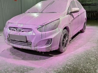 2011 Hyundai Solaris I, белый, 435000 рублей, вид 3