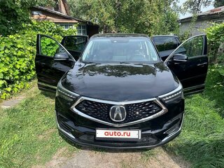 2018 Acura RDX III, чёрный, 2347107 рублей, вид 2